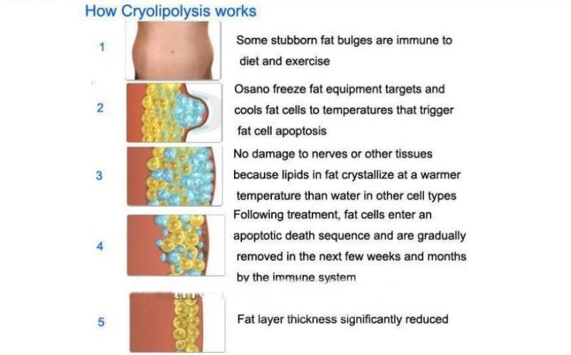 USERMA~166 USERMA~166