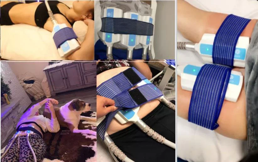 cryoskin-therapy cryoskin-therapy