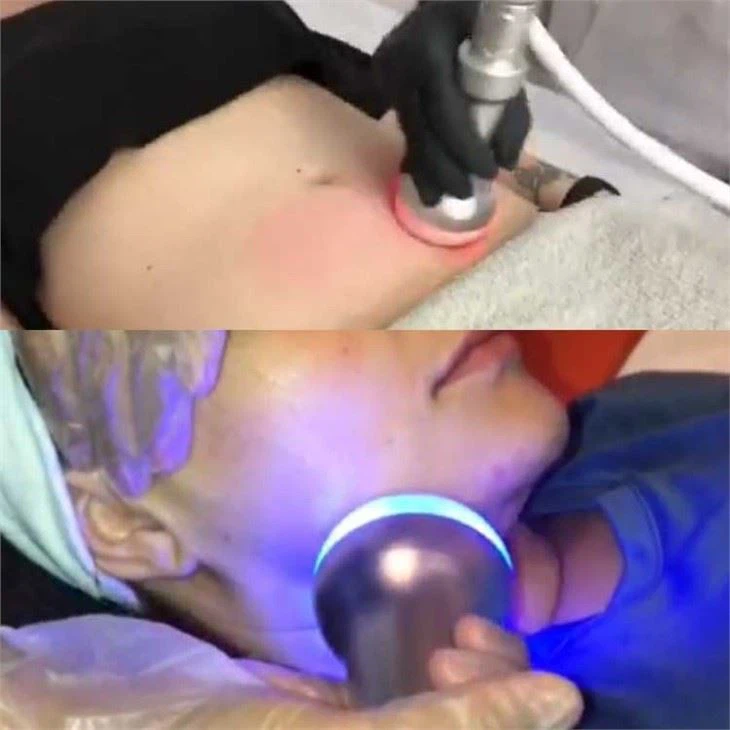Portable Cryoskin 4.0