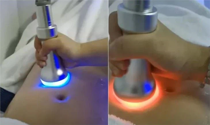Powerful Of Cryotherapy