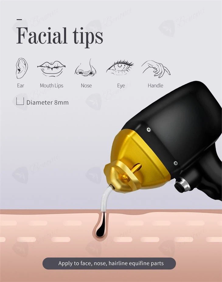 The Worlds Most Advanced Laser Hair Removal System: Soprano Titanium