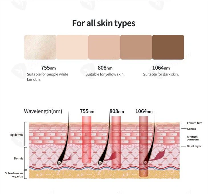 The Worlds Most Advanced Laser Hair Removal System: Soprano Titanium