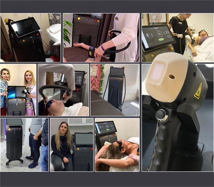 The Worlds Most Advanced Laser Hair Removal System: Soprano Titanium