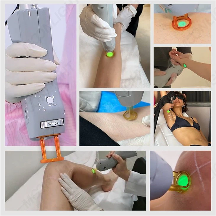 2023 New Cynosure Laser