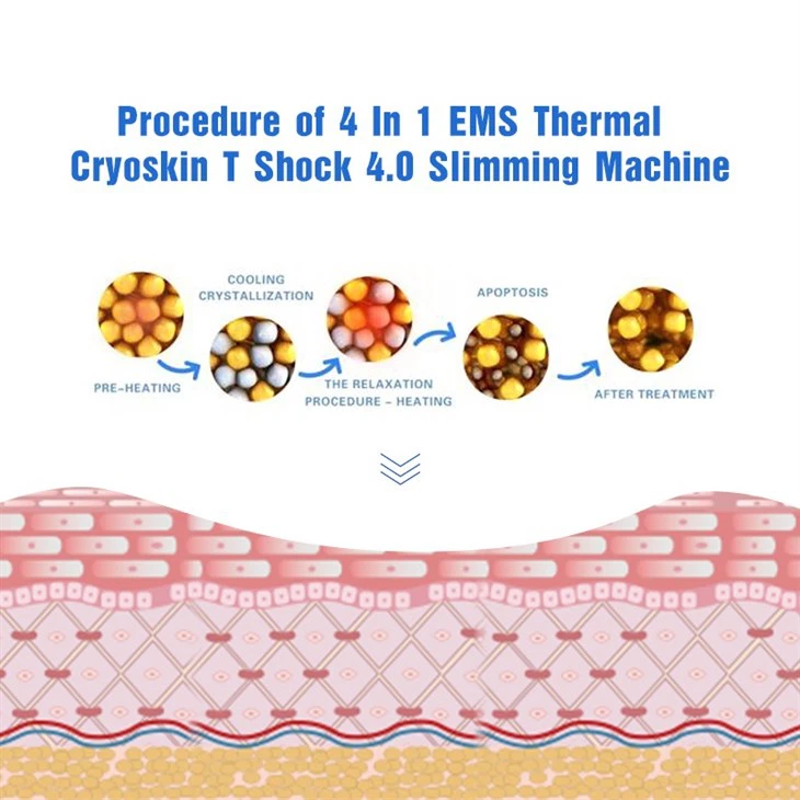 Original Cryoskin Machine