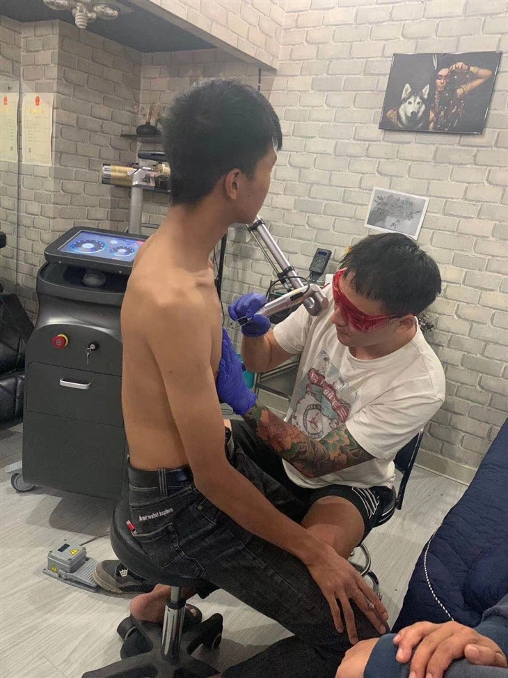Super Tattoo Removal Picosecond Laser