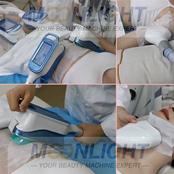 Coolsculpting Machine Cost