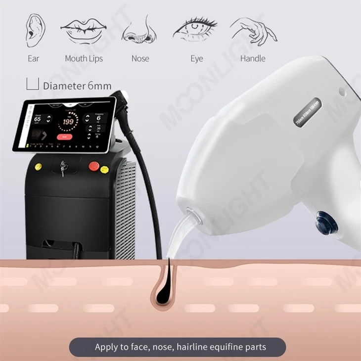 Diode Laser Hair Removal Machines Advantages