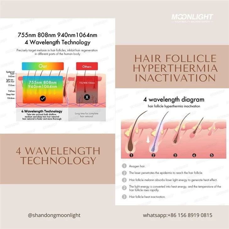 Diode Laser Hair Removal Machines Advantages