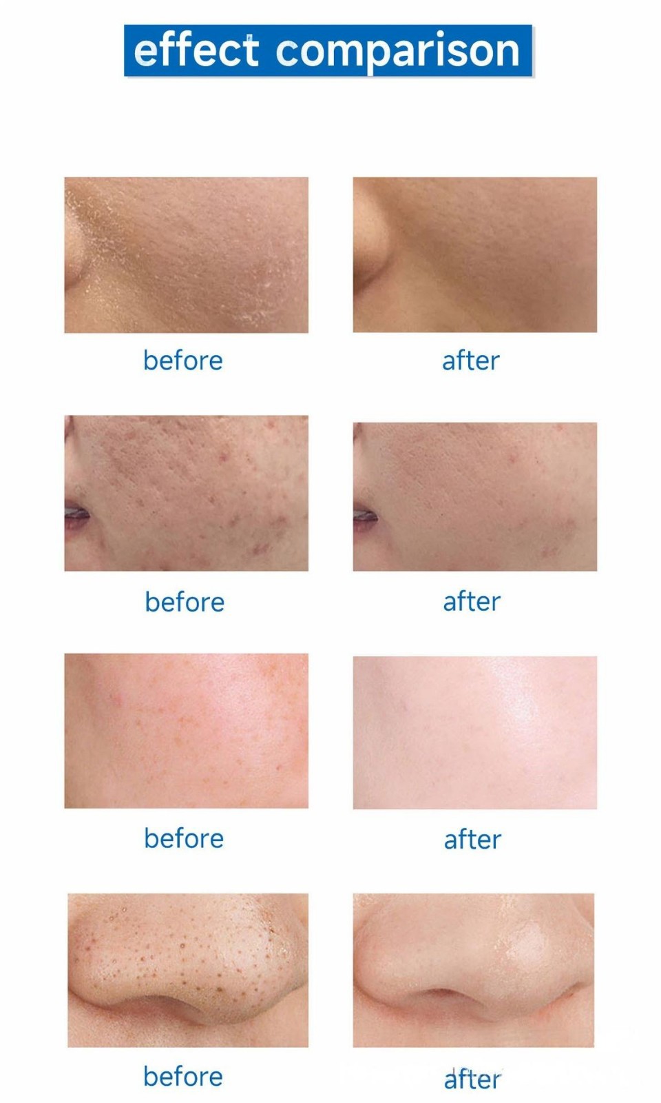 10-in-1 Multifunctional Facial Care Machine factory