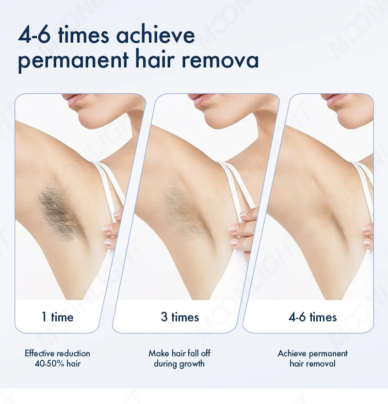 2-in-1 ND YAG + Diode Laser Hair Removal Machine factory