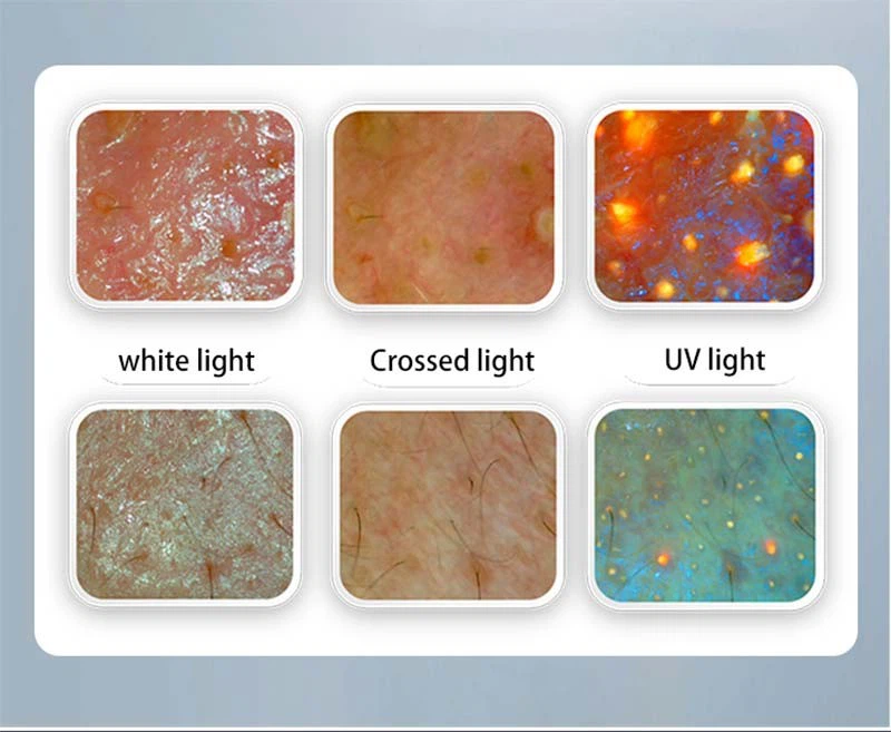 2026 Best-Selling AI Skin & Hair Analyzer high quality