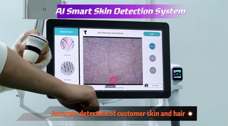 Alma Soprano Titanium AI-Powered Laser Hair Removal Machine