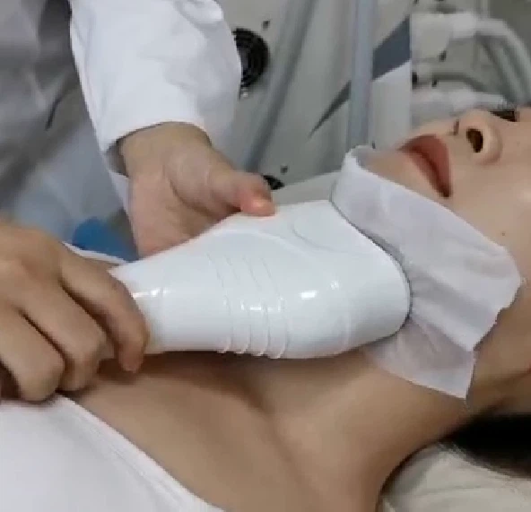 Best Cryolipolysis Antifreeze Membranes