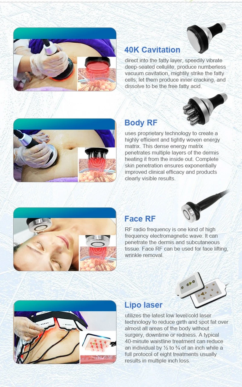 Cryolipolysis Machine – Advanced Non-Invasive Fat Freezing Solution For Clinics & Salons factory