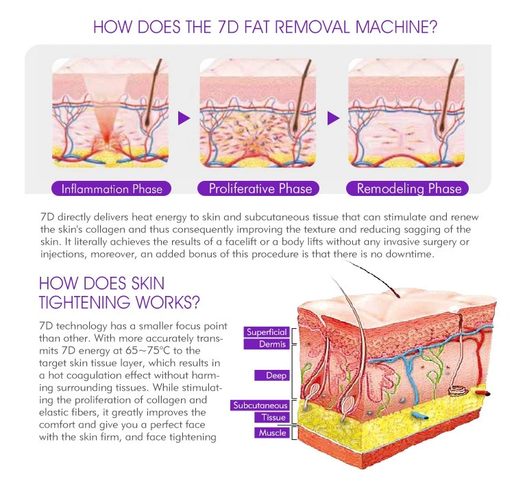 Desktop 7D HIFU Machine: High-Throughput Dual-Handle MMFU Ultra-Lifting Platform high quality