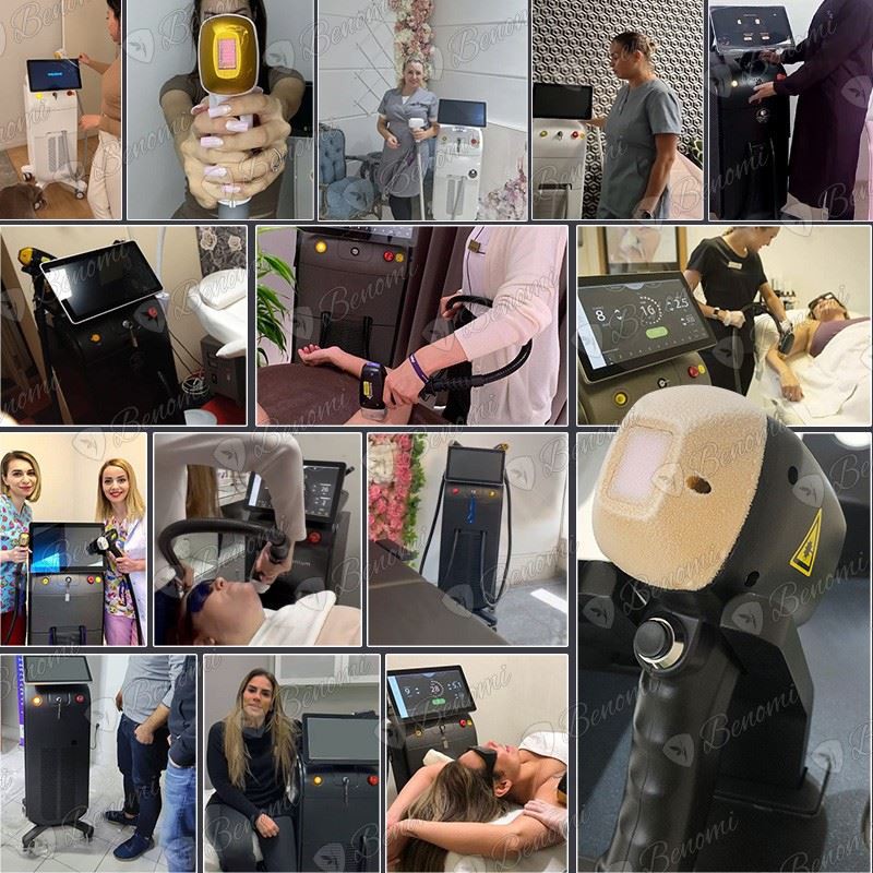 FDA Soprano Titanium Diode Laser Hair Removal Machine suppliers