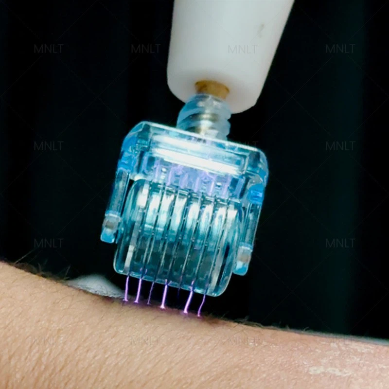 Fusion Plasma Beauty Machine – Next-Generation Skin Renewal Technology suppliers