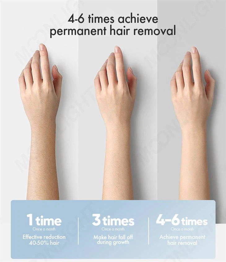 Laser Hair Removal Machine With Customer Management System