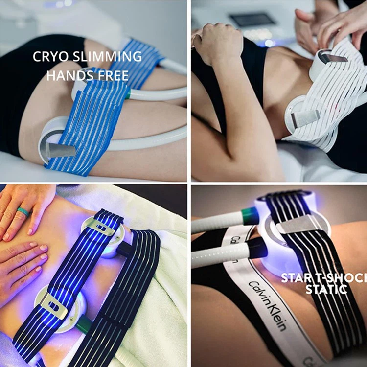 portable cryoskin machine