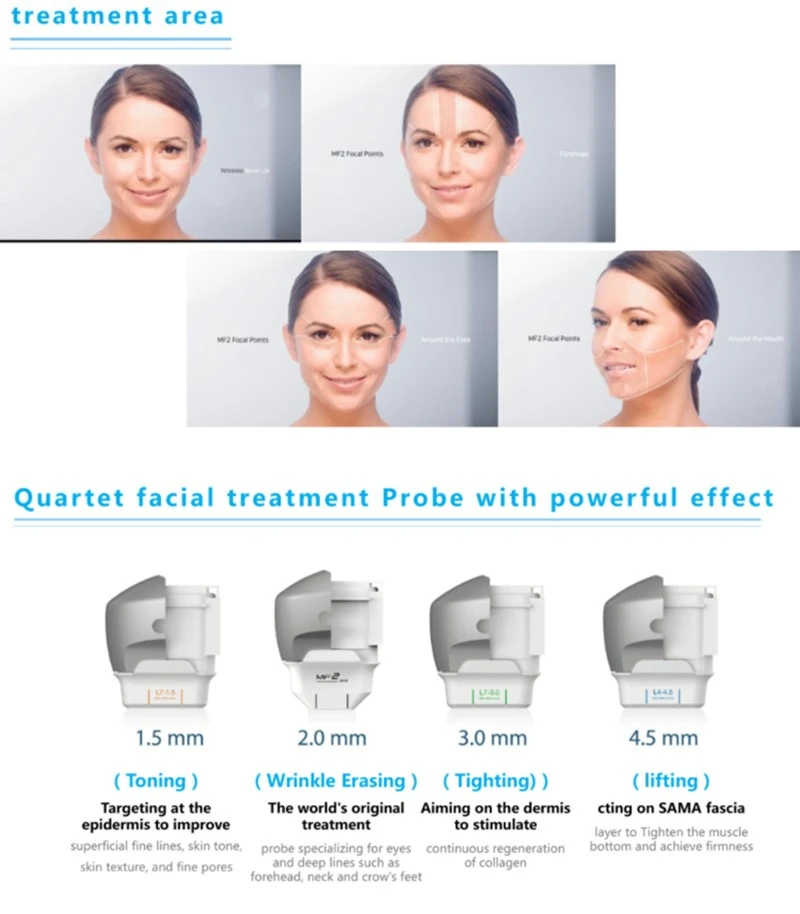 7D-Hifu-treatment