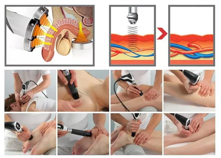 Professional Shockwave Machine For Pain Relief, Muscle Recovery & Body Therapy factory