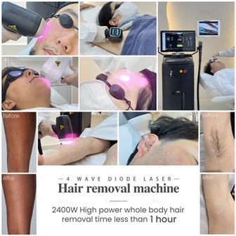 Diode Laser Hair Removal Machine For Body And Face