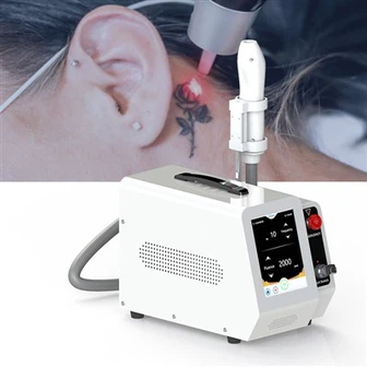 Nd Yag Tattoo Removal Machine