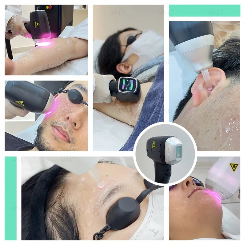 Professional Diode Laser Hair Removal Machine With Advanced 6-Level TEC Cooling System price